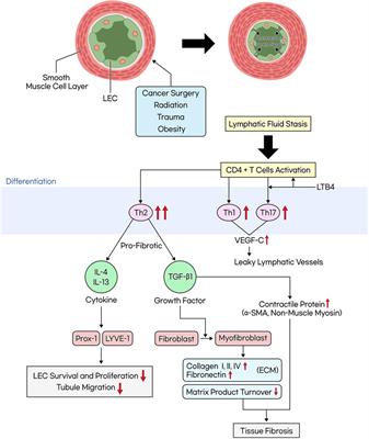 Molecular pathophysiology of secondary lymphedema